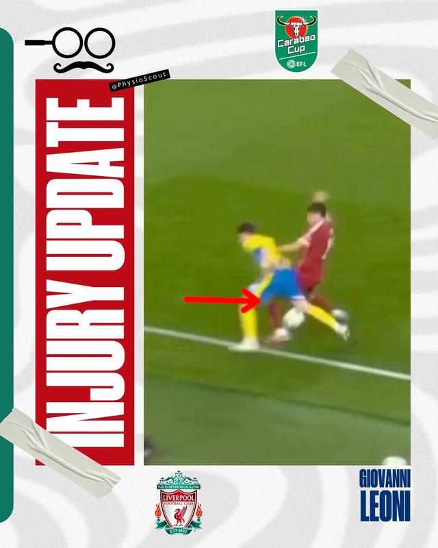 测前交叉韧 测前交叉韧